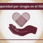 Incapacidad por Cirugía en el ISSSTE: Derechos para Trabajadores de 65 Años con 33 Años de Servicio